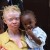 Albino People Suffers Extreme Abduction In Malawi; Human Limbs Sold As Ingredient For Witchcraft Potions, Rituals