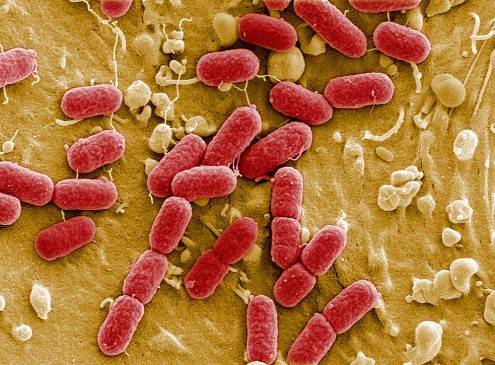 Hebrew University Discovers How Bacteria Outsmarts The Human Immune System