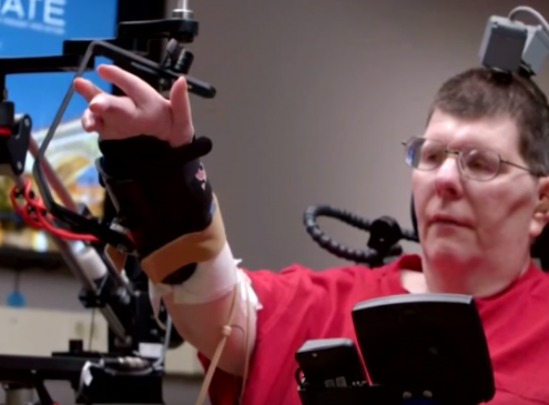 Case Western Reserve University Reveals How To Move Paralytic Arm Using The Mind