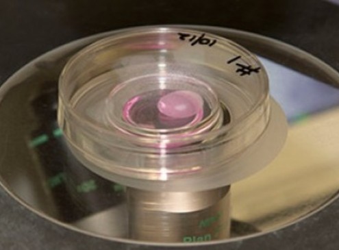 Queensland Researchers Grow Tiny Kidneys in Lab