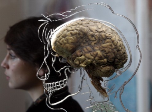 University of Iowa Healthcare Discovers Stimulating the Brain Can Reduce Symptoms of Schizophrenia [Video]