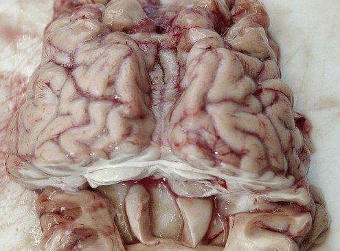 Brain Invading Worms Concern Experts; Outbreak Must Be Avoided [Video]
