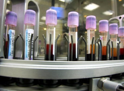 The Single Blood Test That Could Identify All The Viruses That Infected A Person [VIDEO]
