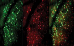 EXCITATORY (GREEN) AND INHIBITORY (RED) NEURONS